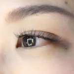 なぜ3週間で再来していただくか…