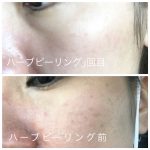 肌のもとを変えないと意味がないでしょ!