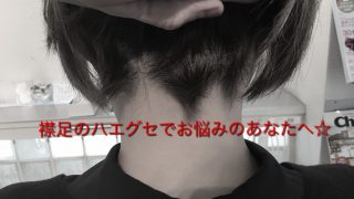 めちゃくちゃ短めのショートに憧れる！でも襟足の生えグセが・・・