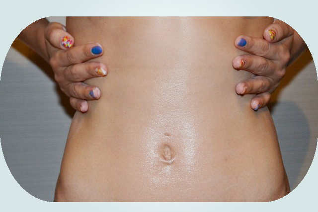 Affect  delipidex howto14